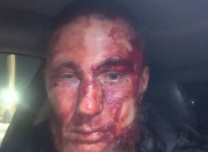 Участник СВО в Красноярском крае дал отпор напавшим преступникам, но ему грозит срок за самооборону