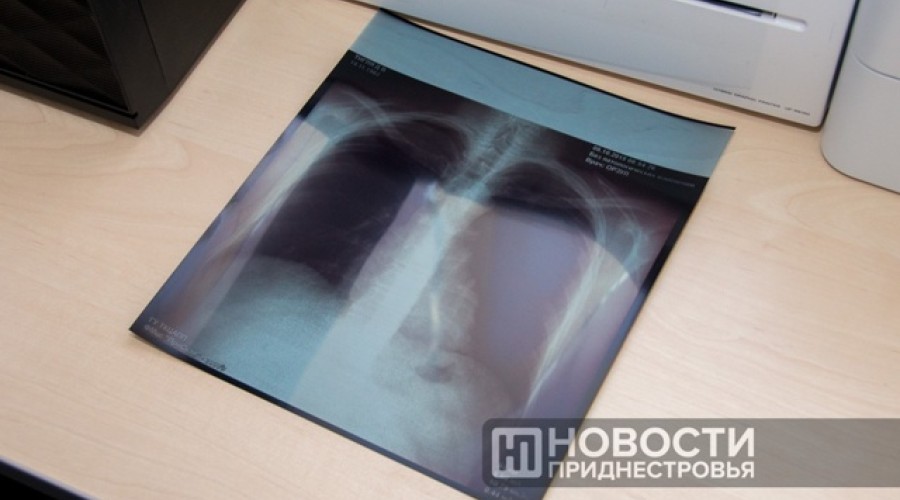 В Тирасполе тысячи детей не прошли пробу Манту из-за отказов родителей