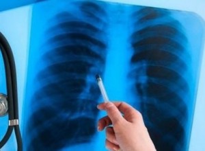 Флюорография выявляет до 60% случаев туберкулёза на ранней стадии в ПМР