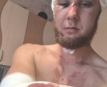 Участник СВО в Красноярском крае дал отпор напавшим преступникам, но ему грозит срок за самооборону