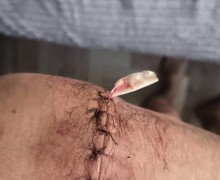 Участник СВО в Красноярском крае дал отпор напавшим преступникам, но ему грозит срок за самооборону